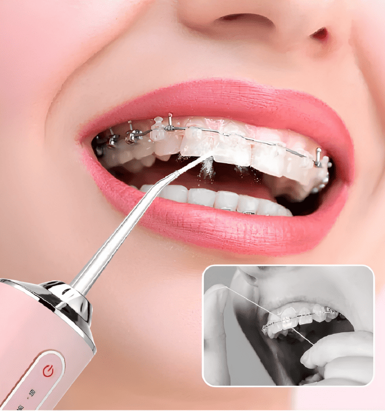 Irrigador Oral - Pure Jet™ - Oferta Limitada